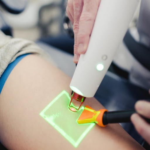 Tratamento de Varizes a Laser